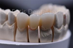 China Customizable Thickness Multilayer Zirconia Ceramic Dental Material on sale