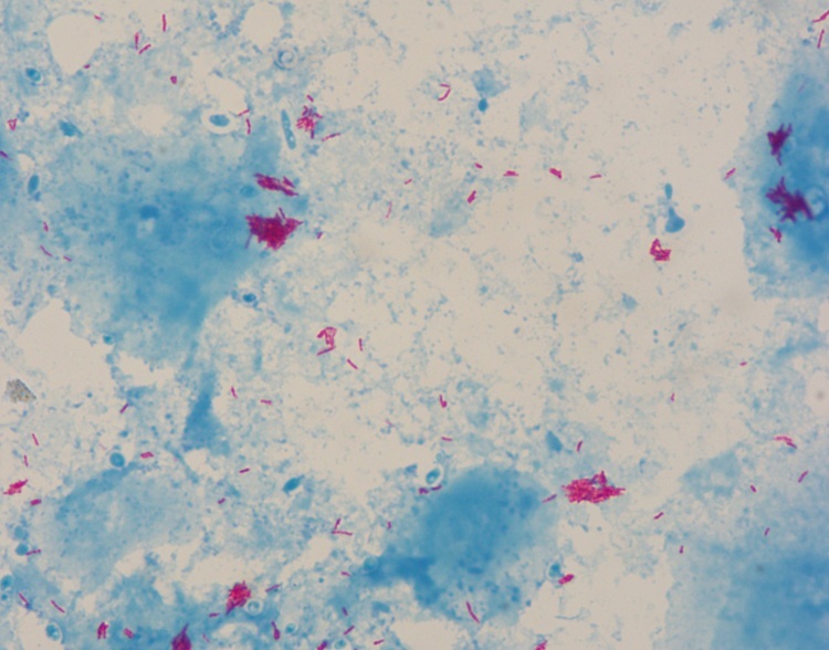 Acid Fast Stain Kinyoun Stain Reagents Solution For Medical Diagnose / Research