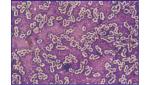 Negative Staining Bacterial Capsule Stain Reagents 2vials×20ml/Kit