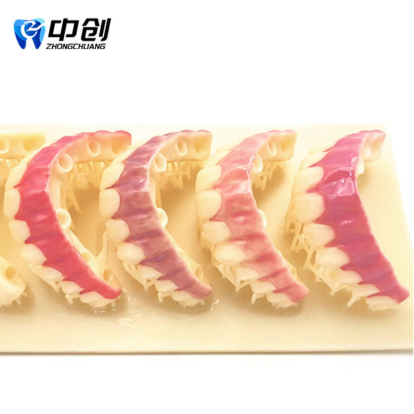 Highly Radiopaque Pink Opaque 4 Color Aesthetic Resin for Professional Natural Restoration