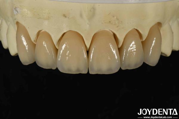 Excellent Biocompatibility Layered Zirconia Within High Aesthetics And Density 6