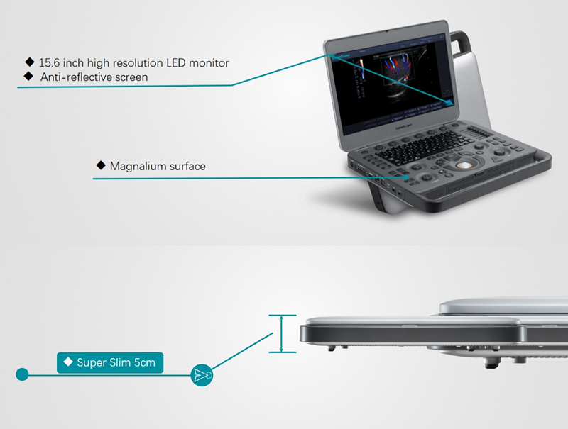 Sonoscape X5 Medical Ultrasound Instruments Machine with Excellent Image Quality