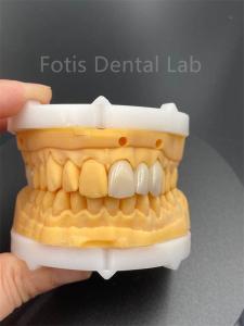 Quality High Durability Multilayered Zirconia Dental Ceramics For Dental Lab Medical Product wholesale