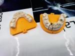 High Strength Yellow Gold Porcelain Dental Crown PFM Ceramic Crown