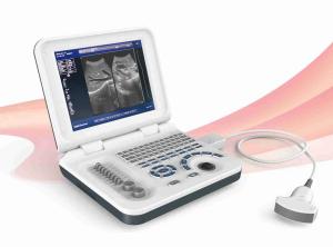 Quality OEM Diagnostic Ultrasound Machines Digital Ultrasound Scanner Durable wholesale