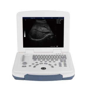 Quality BW Laptop Ultrasound Machine Full Digital Ultrasound Scanner GH580 wholesale