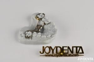 Quality Dental Straightening Retainers Adjustable Comfortable Wear for Teeth wholesale