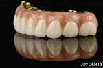 Titanium And Zirconia Comfort Comfortable To Wear Ti-Bar Zirconia Hybrid Bridge