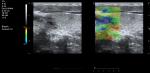 4D Medical Ultrasound Machine Elastography Trolley Ultrasonic Scanning Machine