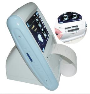 Quality Ultrasound bladder scanner Bladder volume ultrasound scanner wholesale