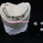 Full Arch Malo Bridge Dental Restoration Zirconia Crowns With Gum Poecelian