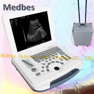 Quality Professional Body High Intensity Focused Ultrasound Human Care Machine wholesale