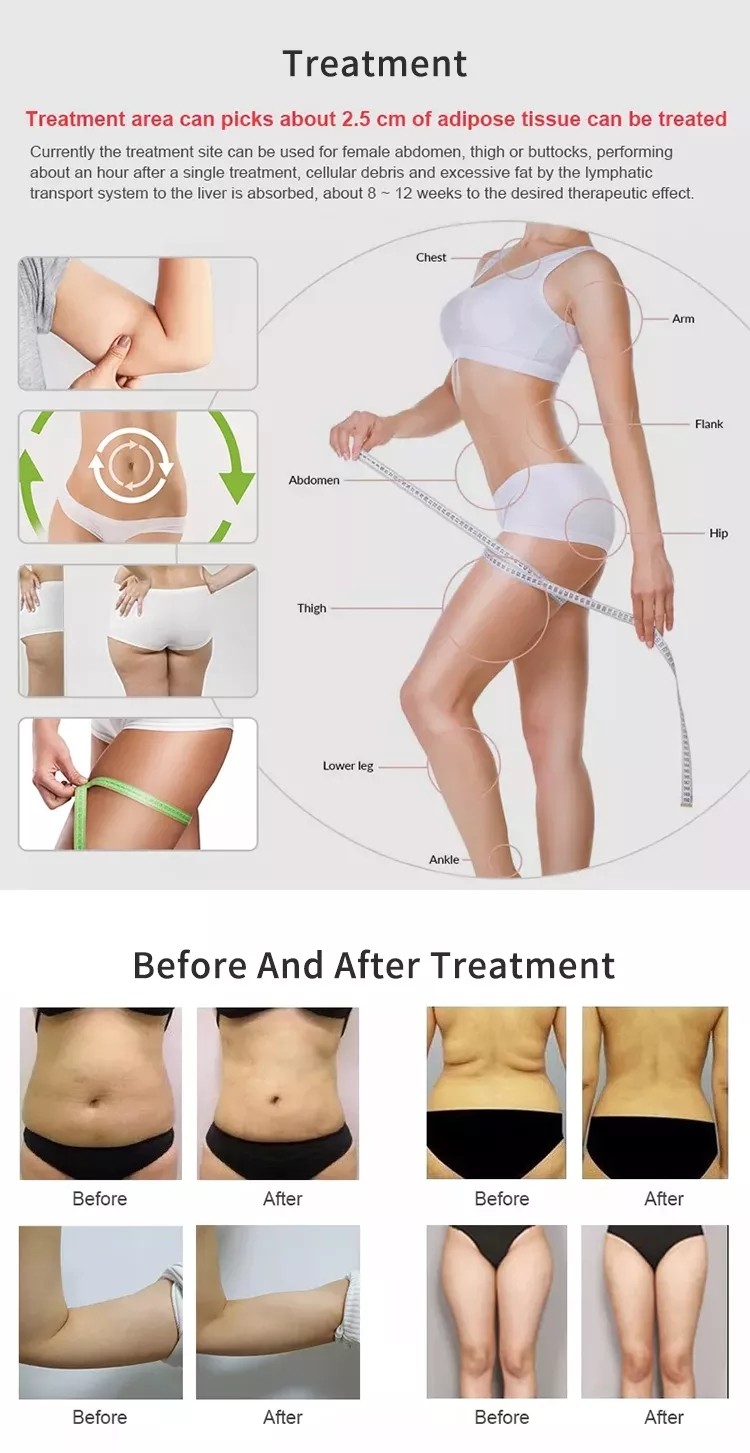 Three 8mm 13mm Rf Handles Weight Loss Slimming Machine Max 200W Ems Neo rf Fat Reduction Device