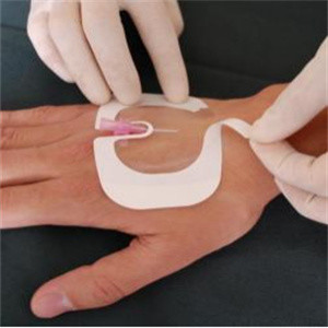 Adhesive Disposable Transparent Film Dressings 10*10cm Antibacterial Antitear