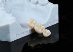 Translucency White Full Contour Zirconia Crown FCZ Monolithic Zirconia Crown