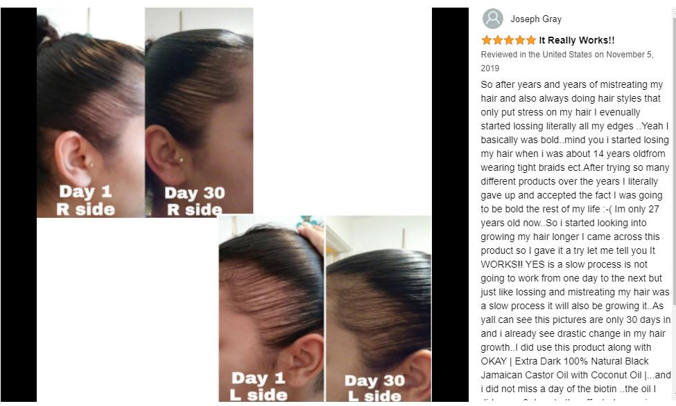 Customization Hair Growth Treatment Serum for Black Women Private Label