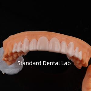 Quality High Esthetics Dental Snap On Smile Standard Dental Lab wholesale