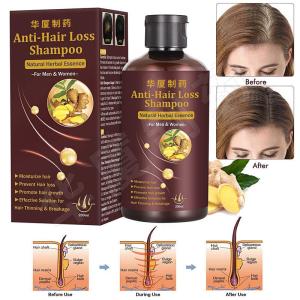 Quality Private Label Hair Loss Shampoo Hair Thickening Shampoo Helps Stop Hair Loss wholesale