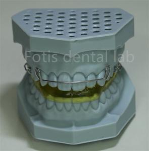 Quality China Dental Lab Lingual Wire Retainer For Teeth Expansion wholesale