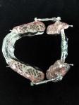 Fixed Appliance Dental Functional Appliance Good Fixation Adequate Anchorage
