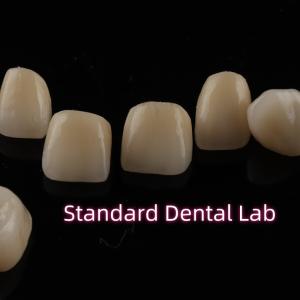 Quality Dental Strong Layered Zirconia Crowns Full Upper Arch Restoration wholesale