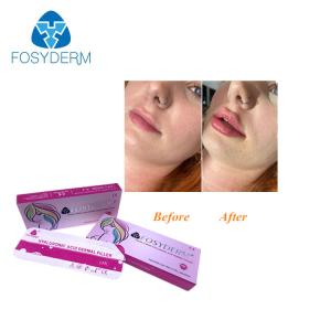 Quality Hyaluronic Acid Dermal Injectable Filler For Nose Face wholesale