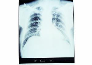 Quality Low Fog Dry Medical Imaging Film KND-A / KND-F For Thermal Printers wholesale