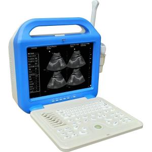 Quality Digital Laptop Ultrasonic Diagnosis Equipment wholesale