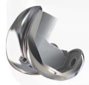 Quality RSK PS Femoral Condyle Revision Knee Joint Prosthesis Replacement wholesale