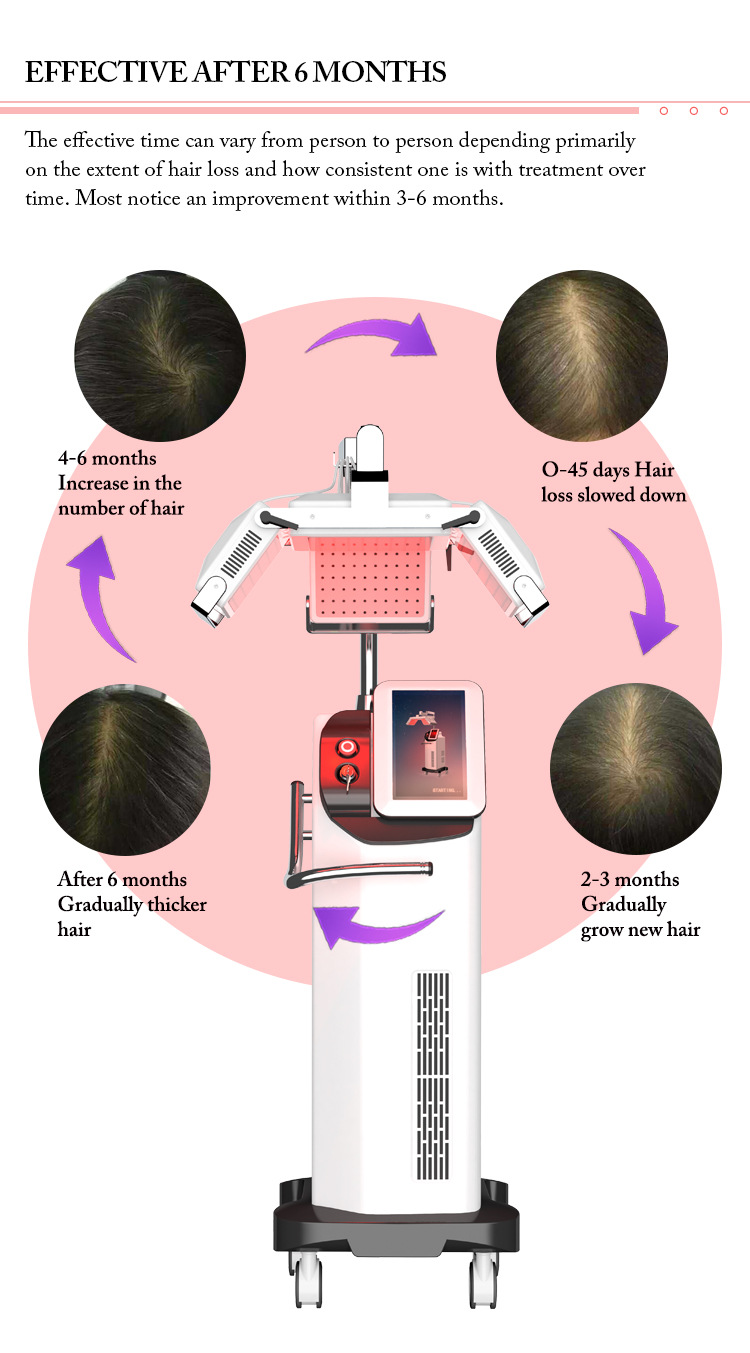 Red Diode Laser High Frequency Beauty Therapy Machine 650NM For Hair Growth OEM