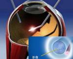Medical Endoscope Sapphire Optical Window , 25mm Sapphire Lens Protector