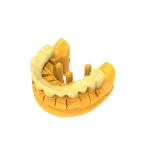 Wear Resistant and Stable Photosensitive Permanent Crown Resin 3D Printing