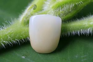 Quality Great Fitness Full Ceramic Biocompatible EMAX Dental Crown wholesale