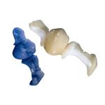 Customized OEM Polishing All-Ceramic Dental Crown Veneer Inlay Onlay