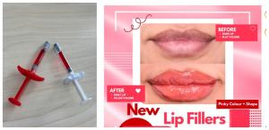 Quality Dermal Lip Fillers Safe Effective For Medical Professionals wholesale