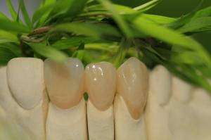 Quality Prosthetic Dentistry Full Zirconium Oxide Crown 5 Stars Design Dental Lab wholesale
