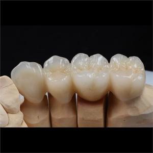 Quality Biocompatible Zirconia Ceramic Dental Crown Tooth Restorations Custom wholesale