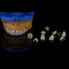 Buy cheap Porcelain Ceramic PFM Dental Crown Material For Restoration from wholesalers