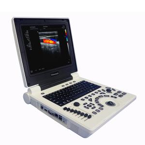 Quality Best Cheap Price Medical Ultrasound Diagnostic System Laptop Portable Color Doppler Ultrasound Machine for Hospital wholesale