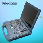 Ultrasound System