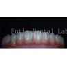 Buy cheap Smooth Surface Cosmetic Tooth Coverings Natural Porcelain Veneers Customizable from wholesalers