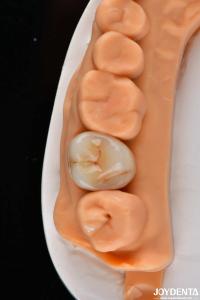 Quality Dental Multilayer Full Zirconia Crowns And Bridges High Translucent Natural Looking wholesale