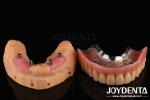 Smooth Acrylic Liquid Teeth Finish 50ml Volume Mild Odor Look For Dental Care