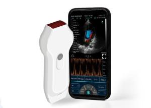 China Personal Ultrasound Scanner Linear+Cardiac Probe 2.2MHz Mobile DICOM Format on sale