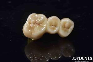 Quality High Biocompatibility Zirconia Full Contour Crown Perfect Fit High Strength wholesale