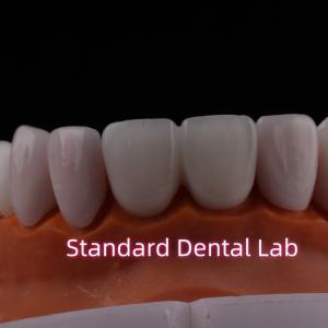 Quality Tranlucent Emax Zirconia Laminate Veneers Porcelain Dental Veneers Chemically Verystable wholesale