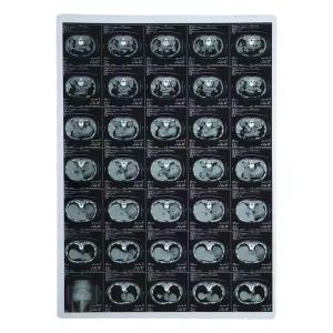 Quality Inkjet Printing Dry Laser X Ray Imaging Film For Hospital Medial Devices wholesale