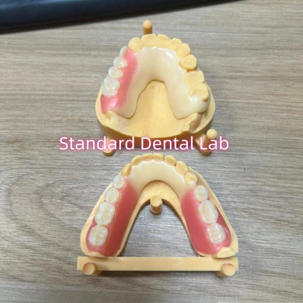Cheap Esthetic Tooth Shade Acetal Framework  Tooth Coloured Clasps Ivoclar Set Up for sale