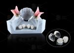 CE FDA Ball Attachment Dentures Comfortable Denture Ball Attachment Long Lasting