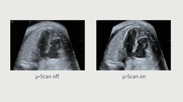 New design cardiac and 4d function Sonoscape P15 ultrasound for hospital